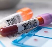 Diagnostic de la prostatite de laboratoire